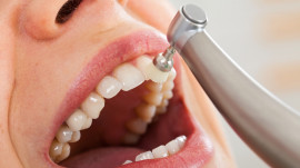Zahnarzt poliert Zhne mit elektrischem Brstchen